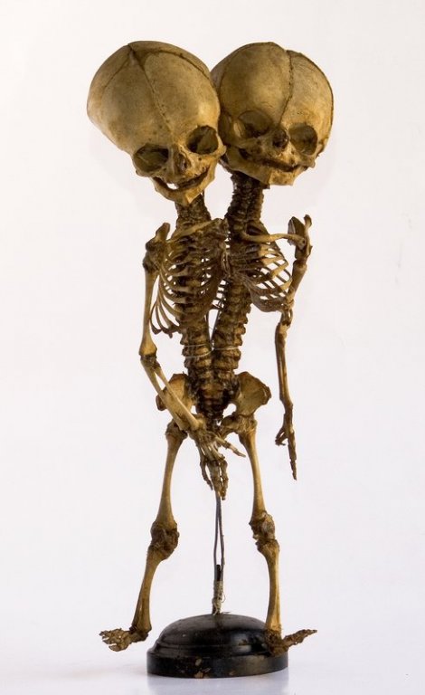 scheletri2