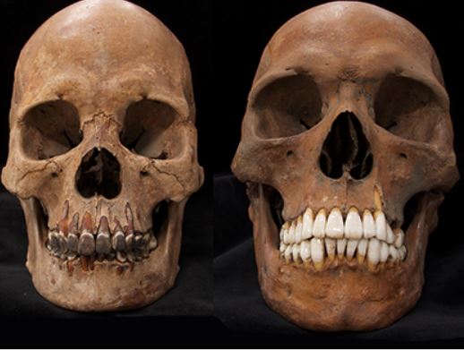 edo-skull-with-blackened-teeth