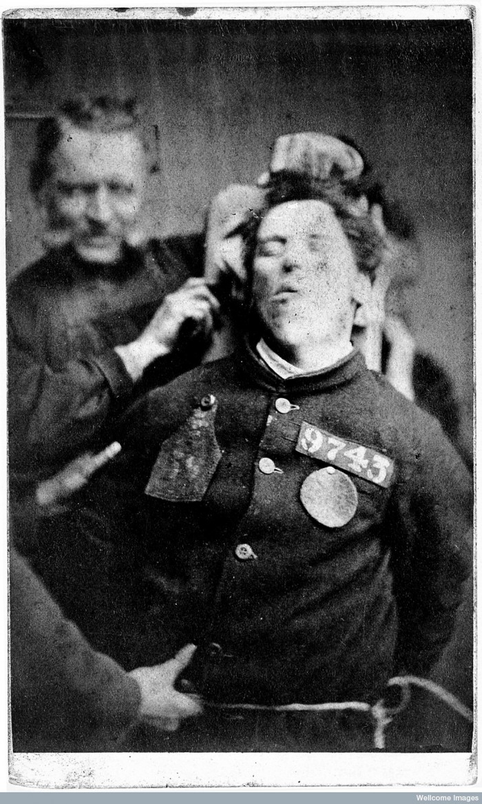 L0019072 West Riding Lunatic Asylum: man restrained by warders; 1869