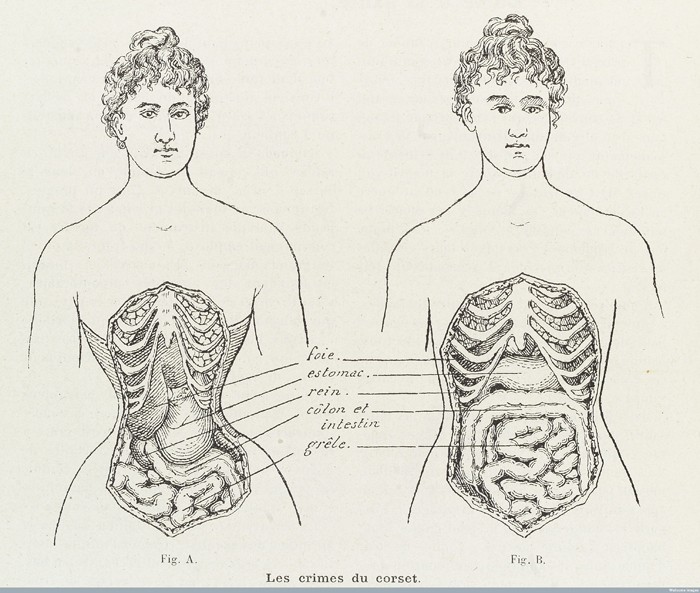 L0038404 Illustrations to denounce the crimes of the corset Credit: Wellcome Library, London. Wellcome Images images@wellcome.ac.uk http://wellcomeimages.org 2 Illustrations to denounce the crimes of the corset and how it cripples and restricts the bodily organs in women. Engraving 1908 Published:  -  Printed: 10th October 1908 Copyrighted work available under Creative Commons Attribution only licence CC BY 4.0 http://creativecommons.org/licenses/by/4.0/