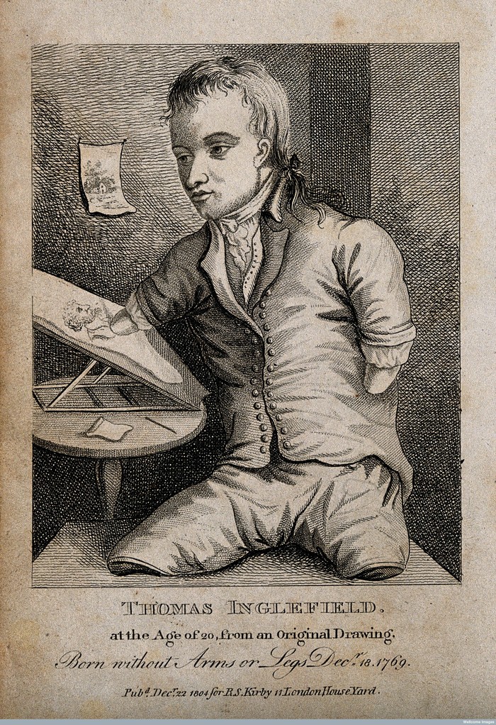 V0007138 Thomas Inglefield, an artist born without limbs, aged twenty Credit: Wellcome Library, London. Wellcome Images images@wellcome.ac.uk http://wellcomeimages.org Thomas Inglefield, an artist born without limbs, aged twenty. Engraving, 1804. 1804 Published: 22 December 1804 Copyrighted work available under Creative Commons Attribution only licence CC BY 4.0 http://creativecommons.org/licenses/by/4.0/