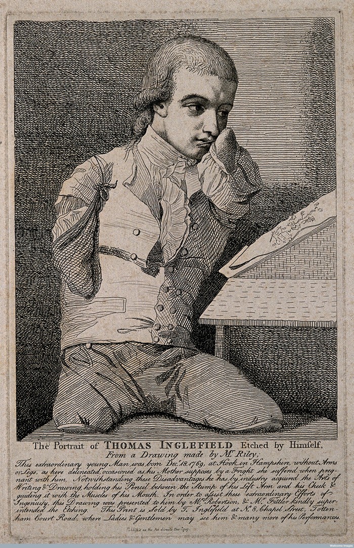 V0007139 Thomas Inglefield, an artist born without limbs. Etching by Credit: Wellcome Library, London. Wellcome Images images@wellcome.ac.uk http://wellcomeimages.org Thomas Inglefield, an artist born without limbs. Etching by T. Inglefield, 1787, after C.R. Ryley. 1787 By: Charles Reuben Ryleyafter: Thomas Inglefield and James Fittler and RobertsonPublished: Publish'd as the Act directs Decr. 1787 Copyrighted work available under Creative Commons Attribution only licence CC BY 4.0 http://creativecommons.org/licenses/by/4.0/