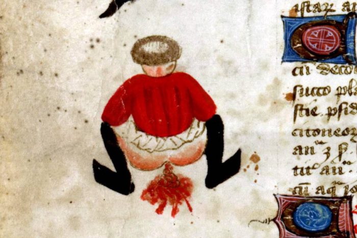John-Arderne-De-arte-phisicali-et-de-cirurgia-England-ca.-1425.-Stockholm-Kungliga-biblioteket-X-118-1280x856