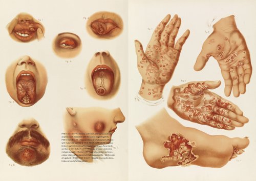 The-Sick-Rose-Or-Disease-and-the-Art-of-Medical-Illustration-0-8