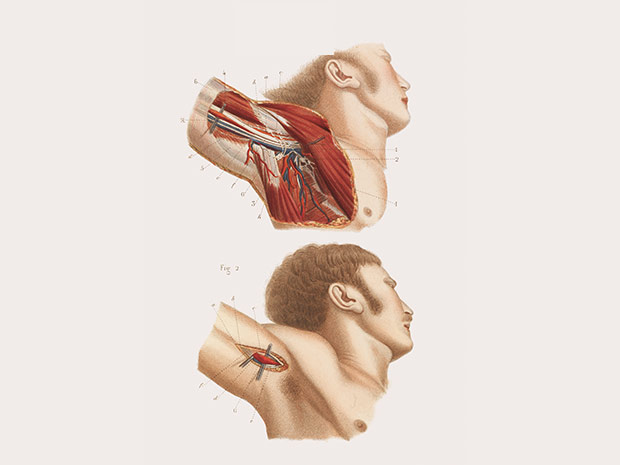 medicalillustration_crucialinterventions-anatomy-of-armpit.jpg%0A