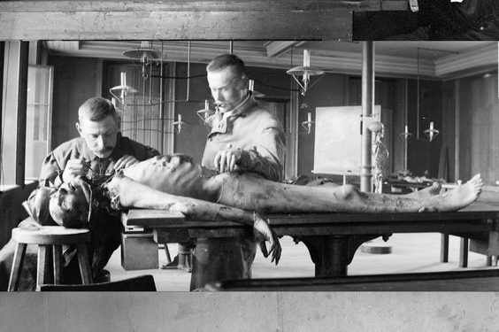 nsfw  decaying flesh vintage autopsy photos