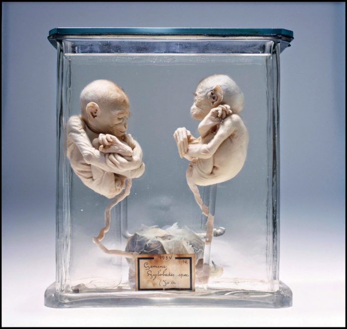 deformed babies in jars u2026 museum vrolik